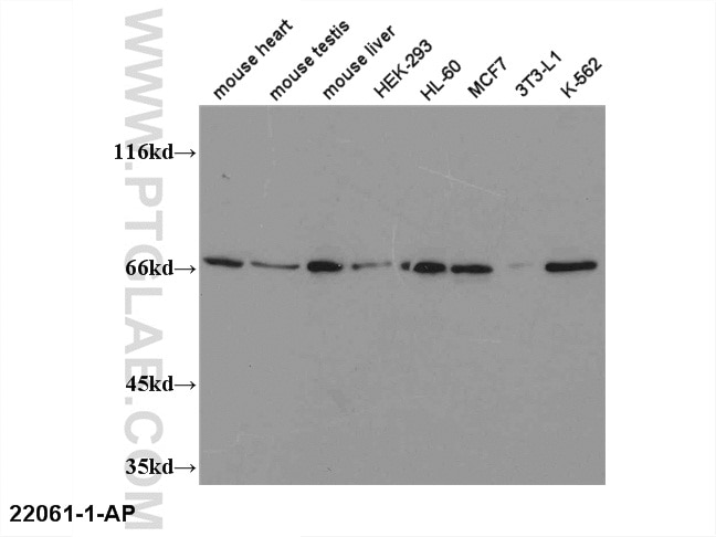 PPAR Gamma Polyclonal antibody