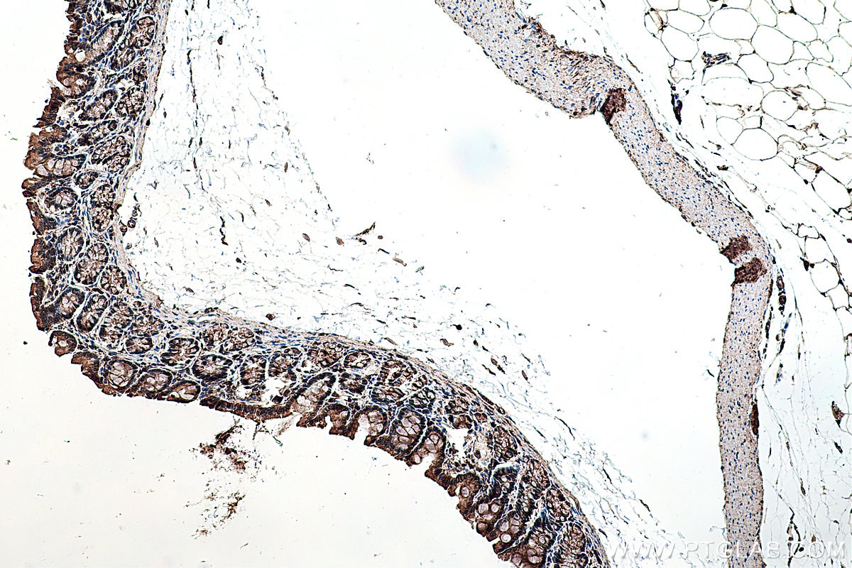 Immunohistochemistry (IHC) staining of rat colon tissue using PPAR Gamma Polyclonal antibody (22061-1-AP)