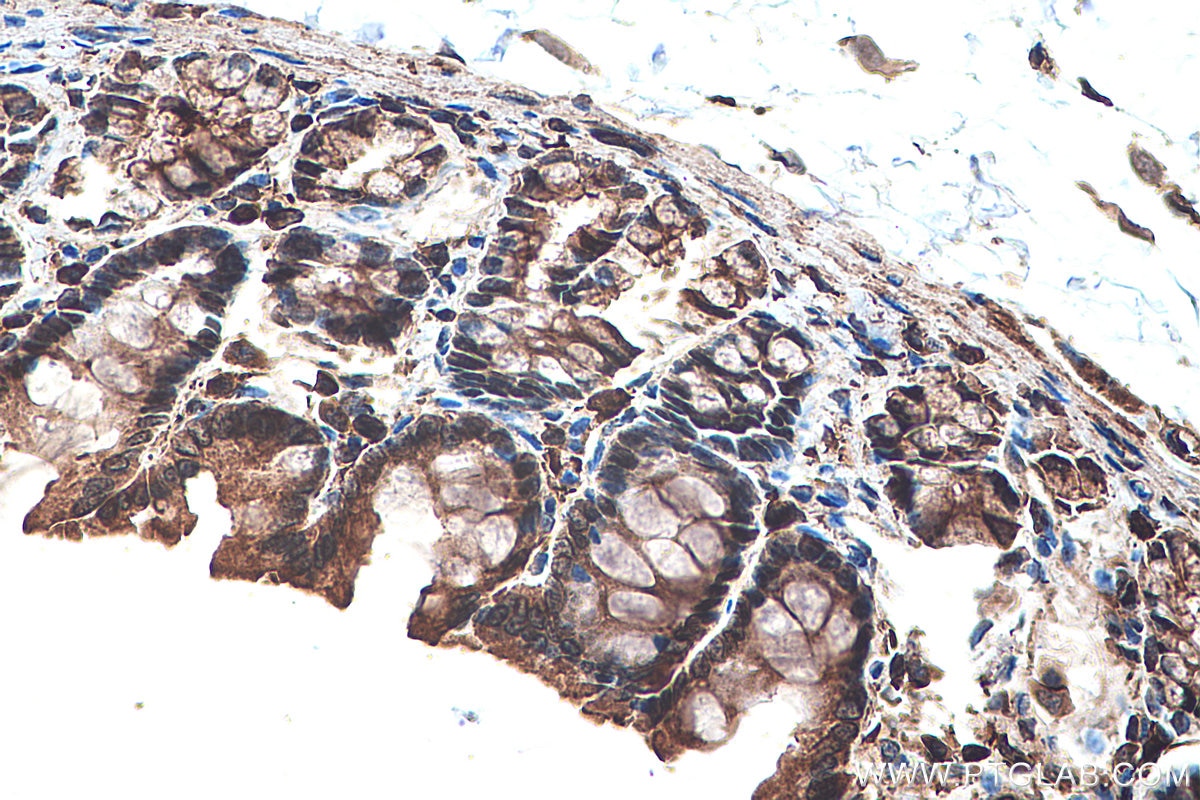 IHC staining of rat colon using 22061-1-AP