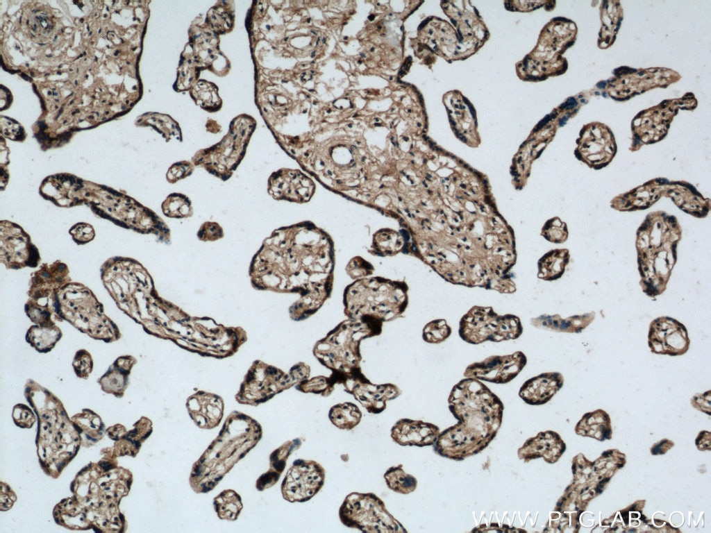 Immunohistochemistry (IHC) staining of human placenta tissue using PPAR Gamma Polyclonal antibody (22061-1-AP)