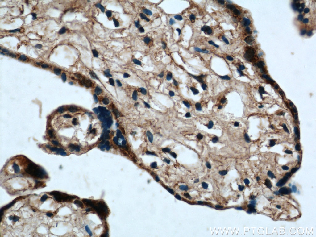 IHC staining of human placenta using 22061-1-AP