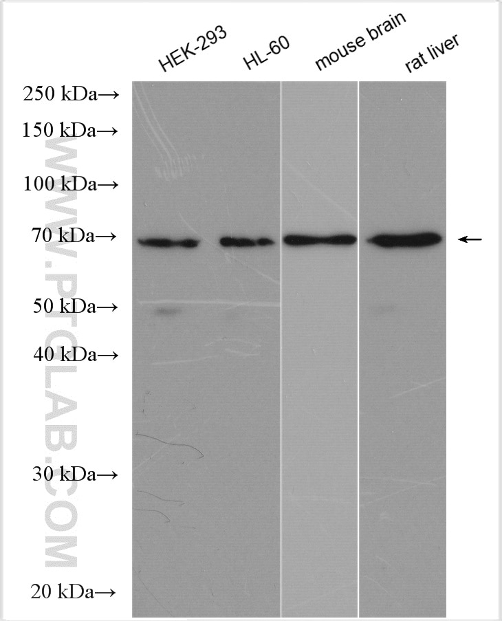 Western Blot (WB) analysis of various lysates using PPAR Gamma Polyclonal antibody (22061-1-AP)