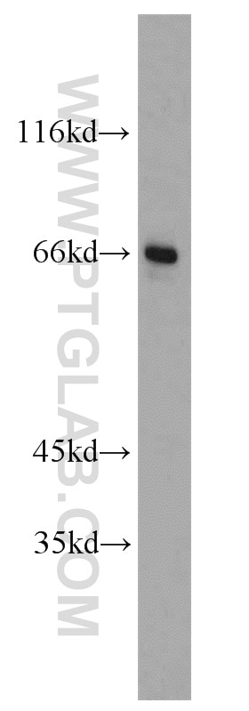 Western Blot (WB) analysis of human brain tissue using PPAR Gamma Polyclonal antibody (22061-1-AP)