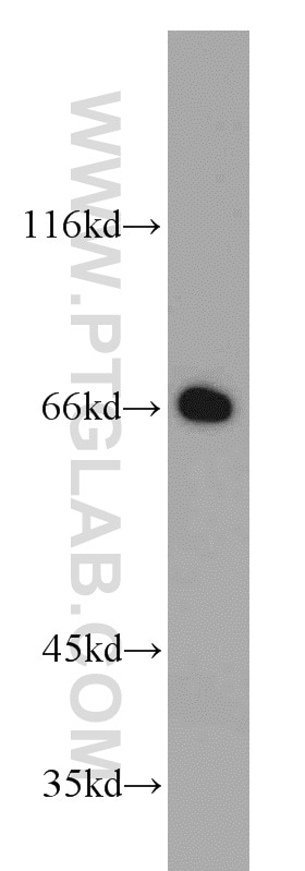 Western Blot (WB) analysis of human heart tissue using PPAR Gamma Polyclonal antibody (22061-1-AP)