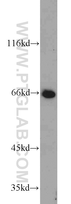 Western Blot (WB) analysis of mouse ovary tissue using PPAR Gamma Polyclonal antibody (22061-1-AP)