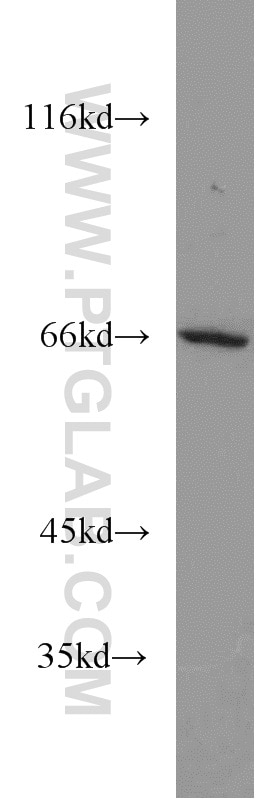 Western Blot (WB) analysis of mouse heart tissue using PPAR Gamma Polyclonal antibody (22061-1-AP)