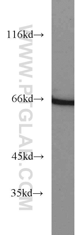 Western Blot (WB) analysis of mouse testis tissue using PPAR Gamma Polyclonal antibody (22061-1-AP)