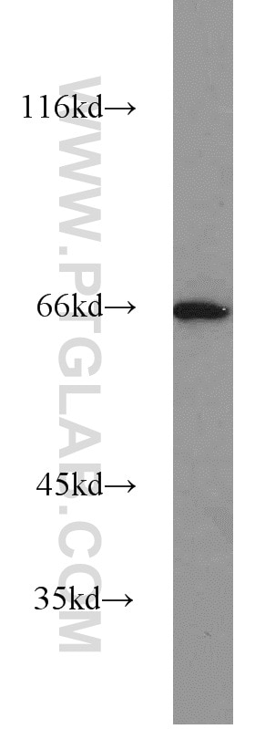 Western Blot (WB) analysis of mouse liver tissue using PPAR Gamma Polyclonal antibody (22061-1-AP)