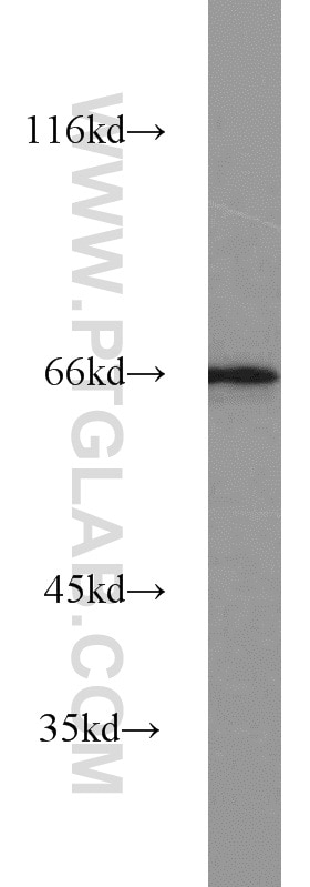 Western Blot (WB) analysis of MCF-7 cells using PPAR Gamma Polyclonal antibody (22061-1-AP)