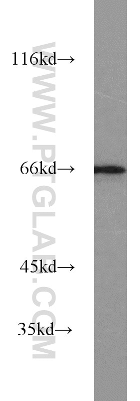 WB analysis of MCF-7 using 22061-1-AP