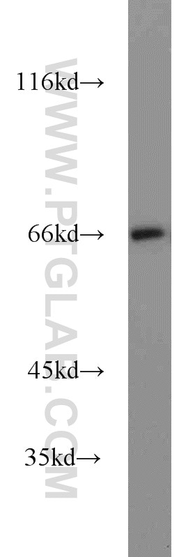 Western Blot (WB) analysis of 3T3-L1 cells using PPAR Gamma Polyclonal antibody (22061-1-AP)