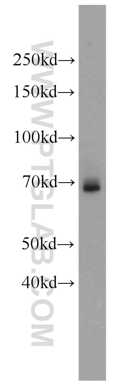 Western Blot (WB) analysis of rat brain tissue using PPAR Gamma Polyclonal antibody (22061-1-AP)