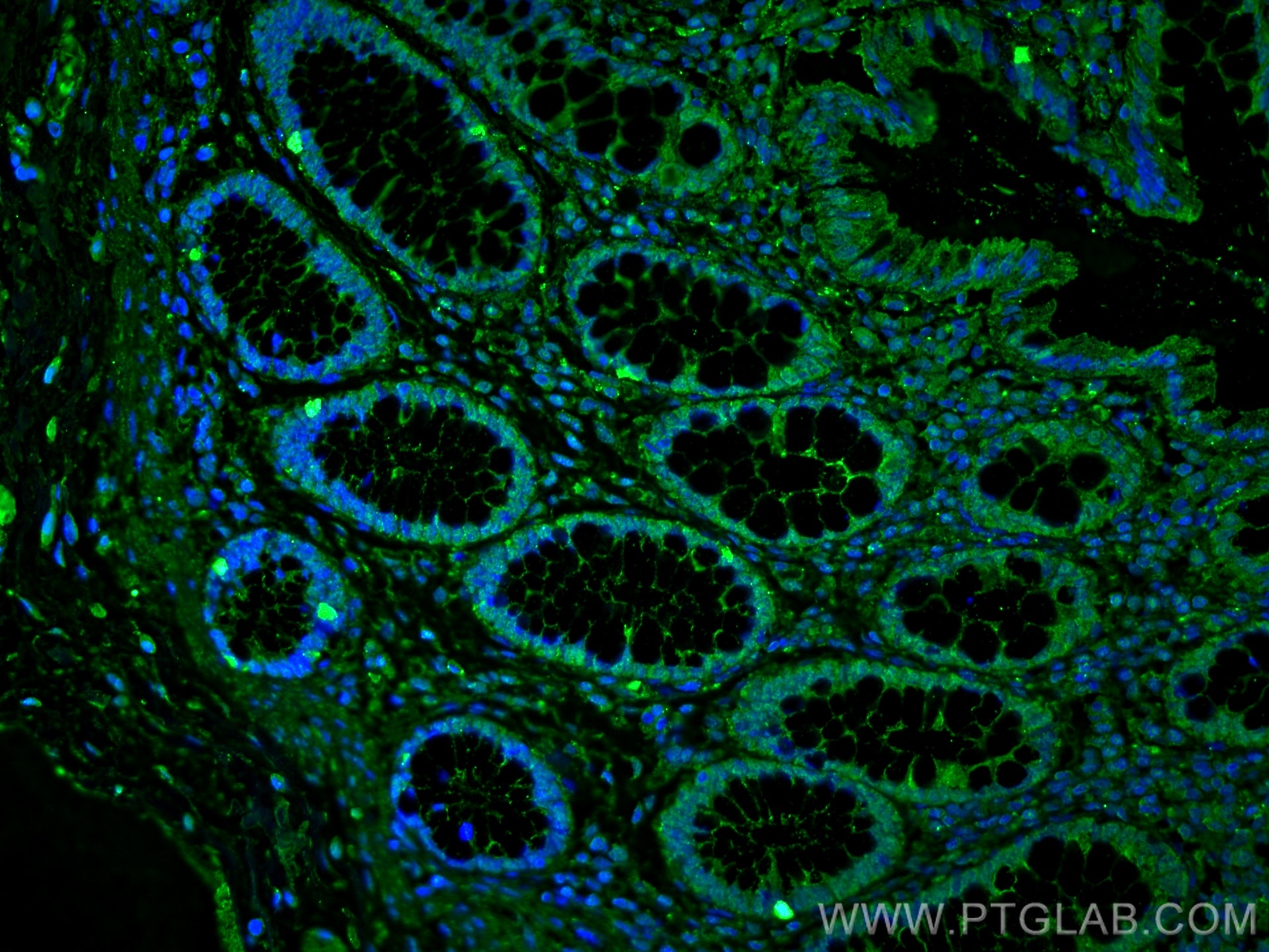 Immunofluorescence (IF) / fluorescent staining of human colon tissue using PPAR Gamma Monoclonal antibody (60127-1-Ig)