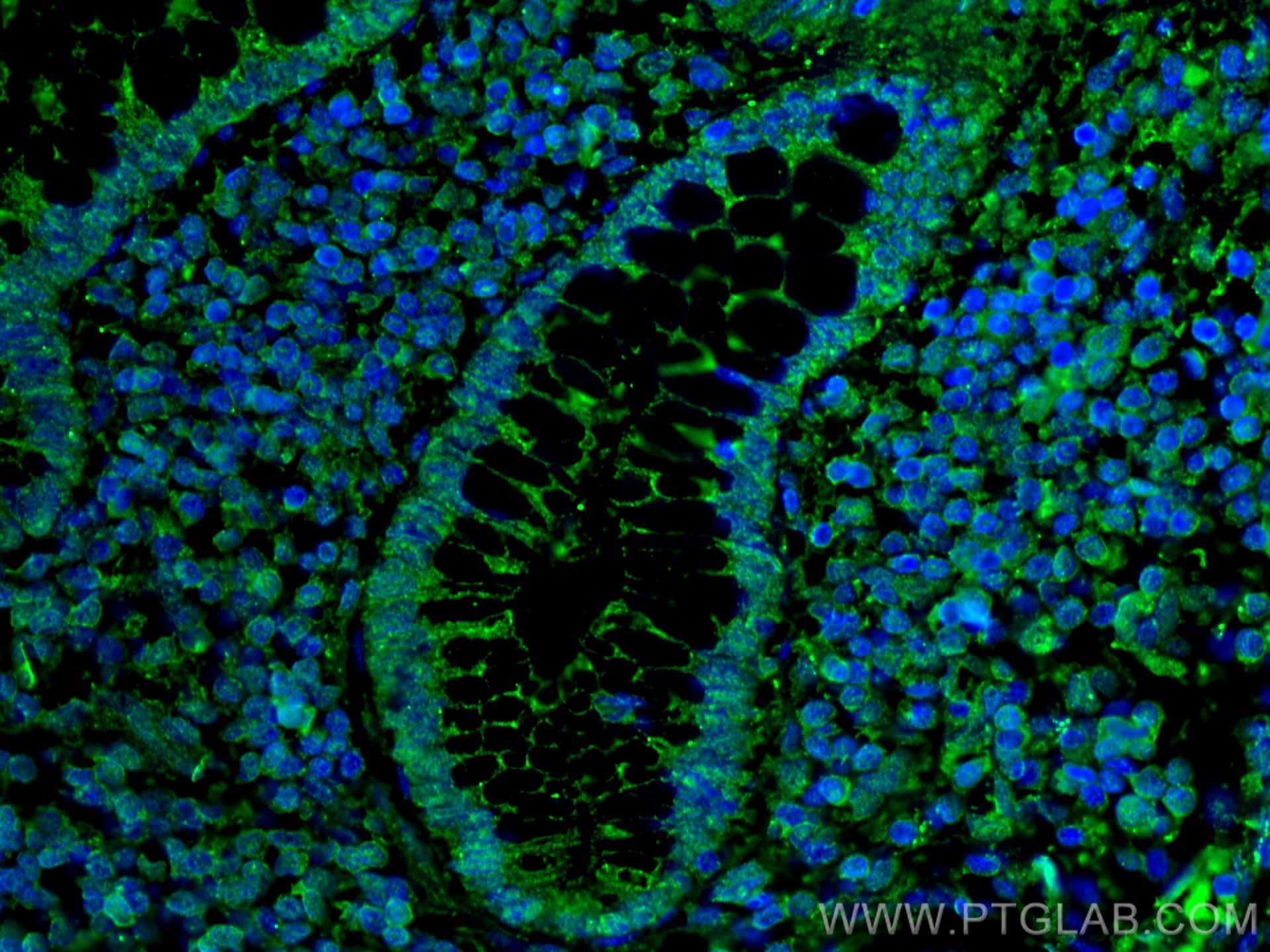Immunofluorescence (IF) / fluorescent staining of human colon tissue using PPAR Gamma Monoclonal antibody (60127-1-Ig)