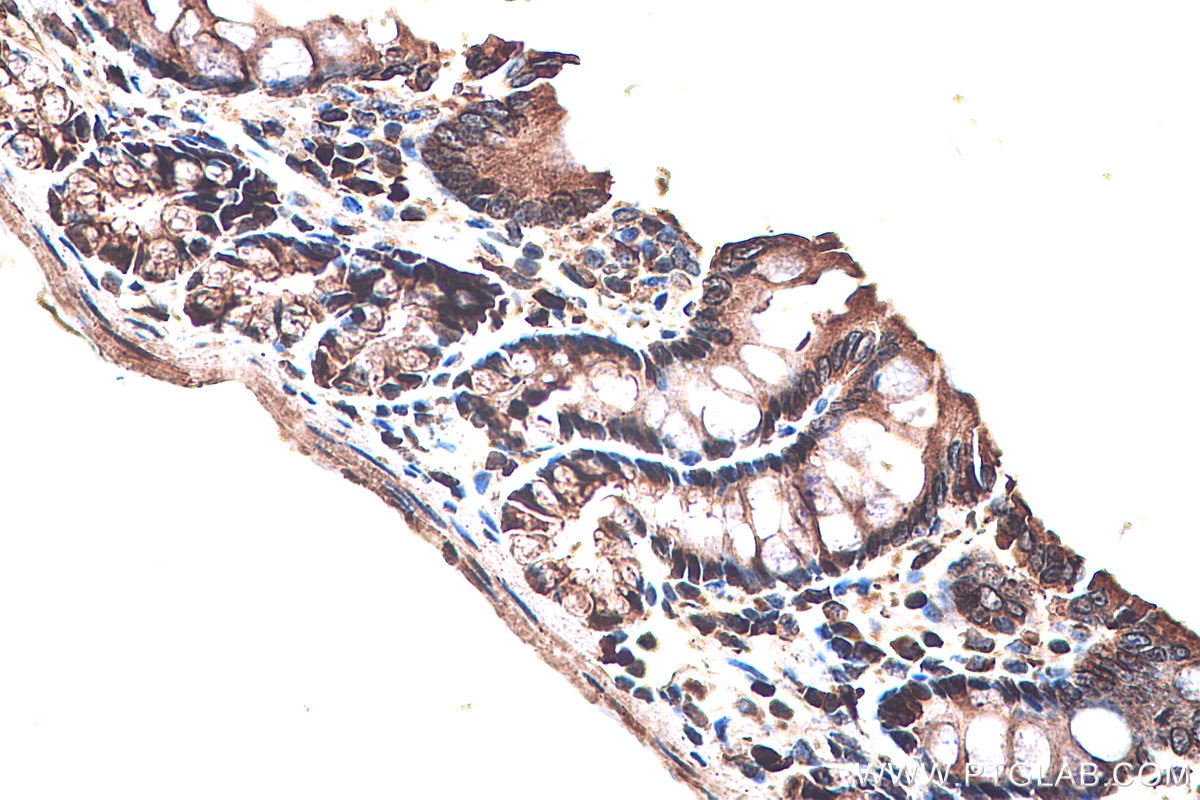 Immunohistochemistry (IHC) staining of rat colon tissue using PPAR Gamma Monoclonal antibody (60127-1-Ig)