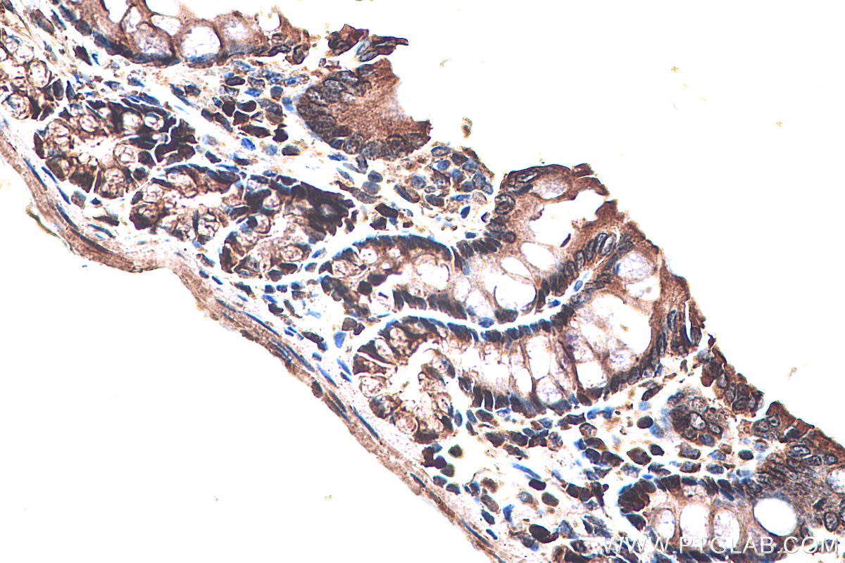 IHC staining of rat colon using 60127-1-Ig