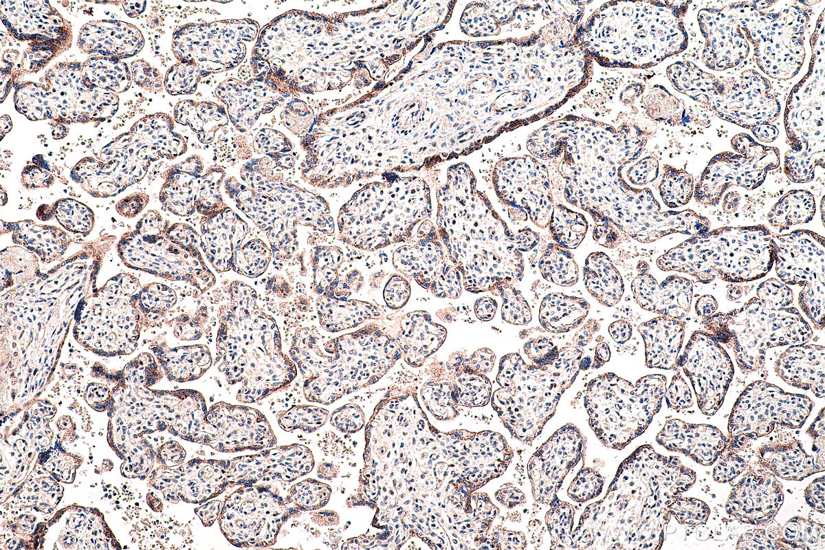 IHC staining of human placenta using 60127-1-Ig