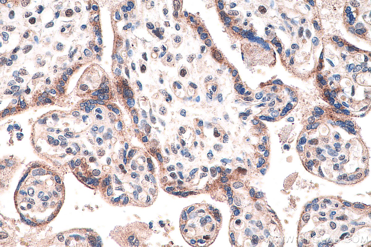 Immunohistochemistry (IHC) staining of human placenta tissue using PPAR Gamma Monoclonal antibody (60127-1-Ig)