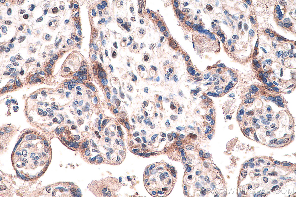 IHC staining of human placenta using 60127-1-Ig