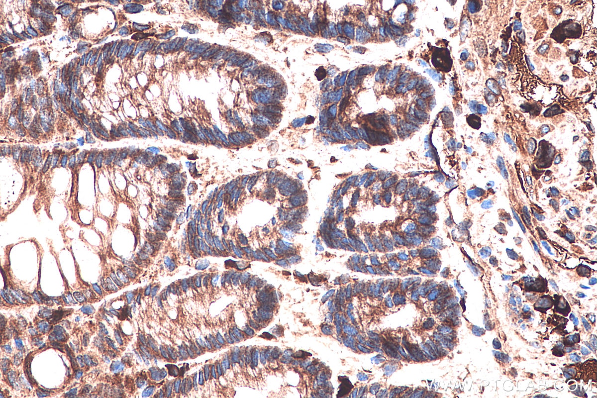 Immunohistochemistry (IHC) staining of mouse colon tissue using PPAR Gamma Monoclonal antibody (60127-1-Ig)