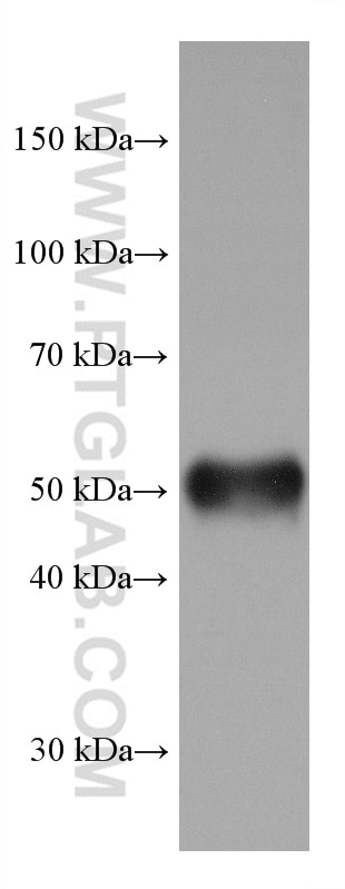 Western Blot (WB) analysis of mouse adipose tissue using PPAR Gamma Monoclonal antibody (66936-1-Ig)