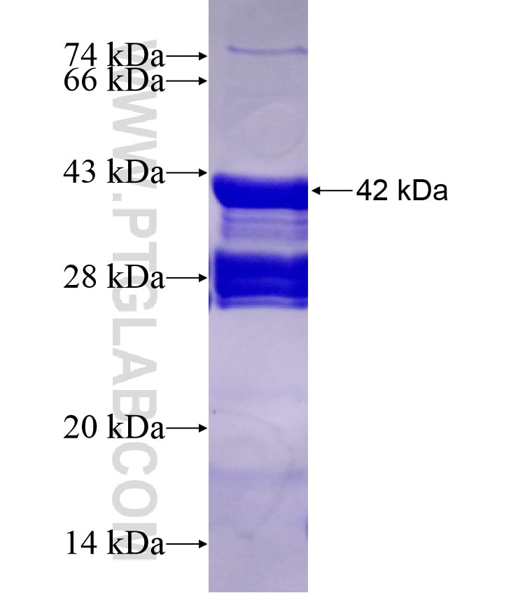 PPARG fusion protein Ag17136 SDS-PAGE