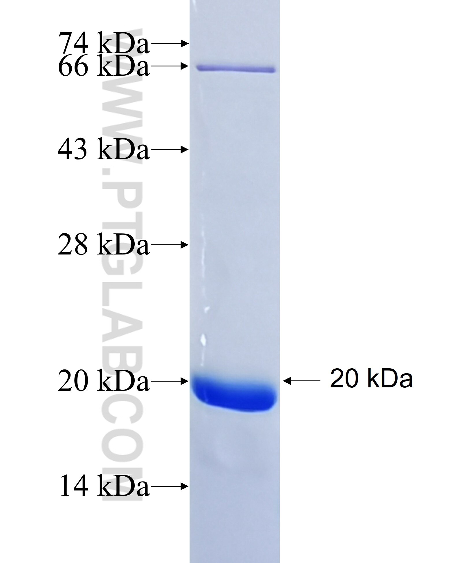 PPARG fusion protein Ag17468 SDS-PAGE