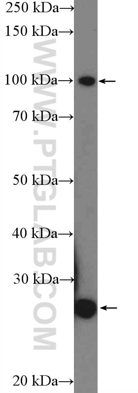 PGC1a Polyclonal antibody