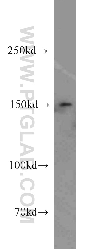 PGC1a Polyclonal antibody