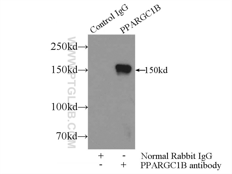 Immunoprecipitation (IP) experiment of mouse liver tissue using PPARGC1B Polyclonal antibody (22378-1-AP)