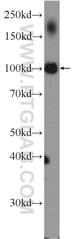 PPARGC1B Polyclonal antibody