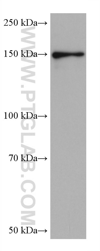 WB analysis of SH-SY5Y using 67821-1-Ig