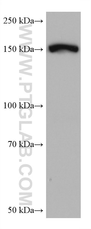 Western Blot (WB) analysis of mouse brain tissue using PPARGC1B Monoclonal antibody (67821-1-Ig)