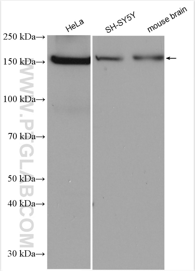 Western Blot (WB) analysis of various lysates using PPARGC1B Monoclonal antibody (67821-1-Ig)