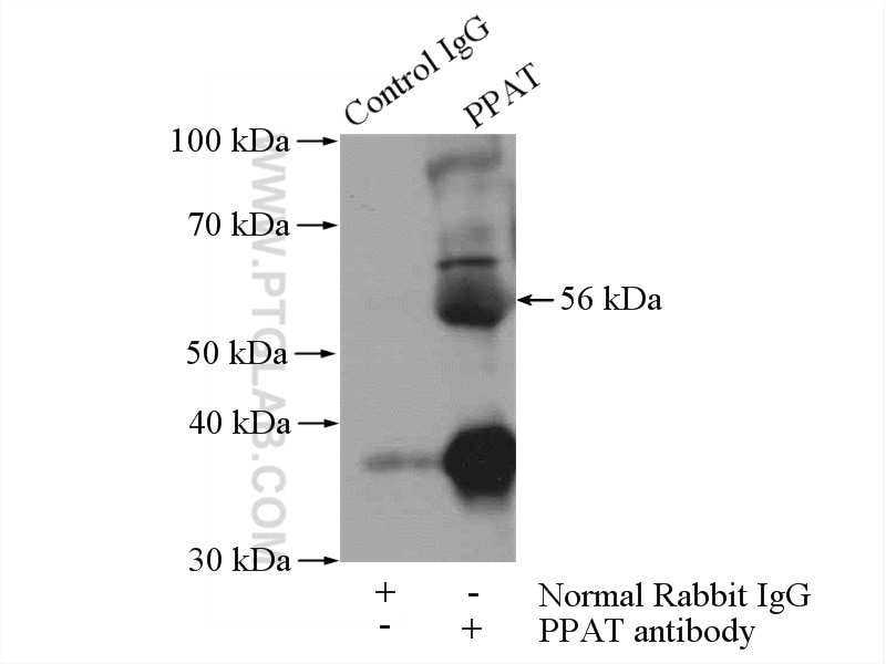 Immunoprecipitation (IP) experiment of HepG2 cells using PPAT Polyclonal antibody (15401-1-AP)