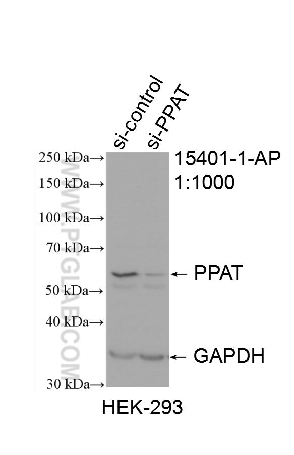 Western Blot (WB) analysis of HEK-293 cells using PPAT Polyclonal antibody (15401-1-AP)