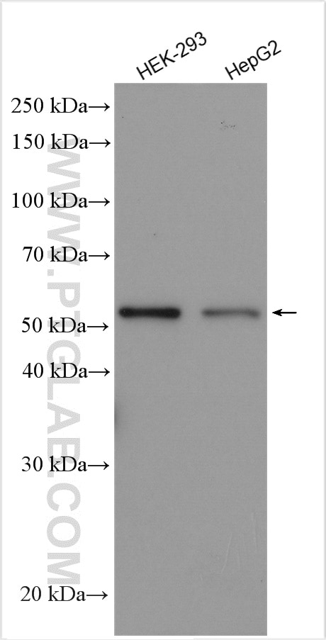 Western Blot (WB) analysis of various lysates using PPAT Polyclonal antibody (15401-1-AP)