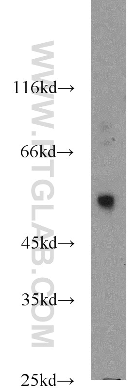 Western Blot (WB) analysis of HepG2 cells using PPAT Polyclonal antibody (15401-1-AP)