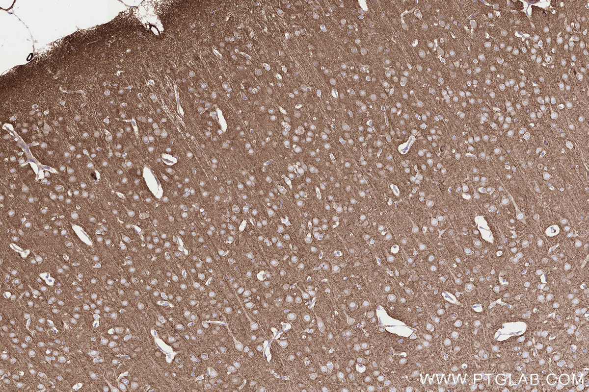 IHC staining of rat brain using 85096-1-RR Immunohistochemistry (IHC) staining of rat brain tissue using PPAT Recombinant monoclonal antibody (85096-1-RR)