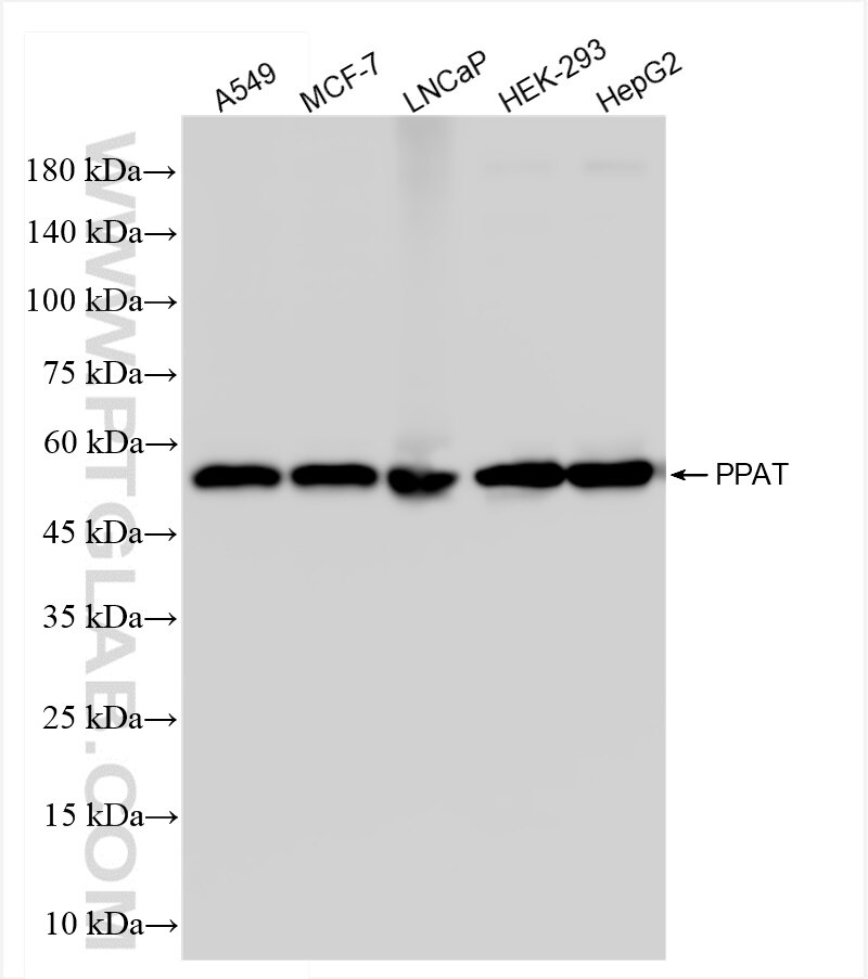 Western Blot (WB) analysis of various lysates using PPAT Recombinant antibody (85096-1-RR)