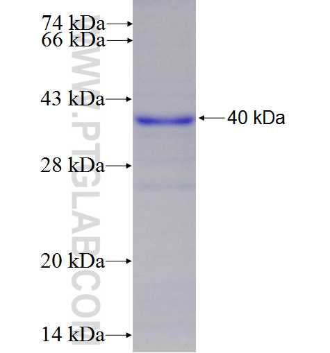 PPAT fusion protein Ag7618 SDS-PAGE