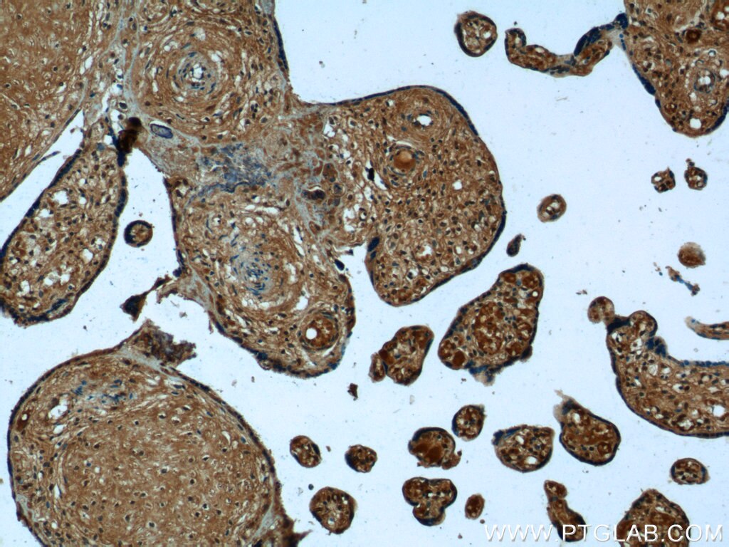 Immunohistochemistry (IHC) staining of human placenta tissue using PPBP,NAP2 Polyclonal antibody (13313-1-AP)