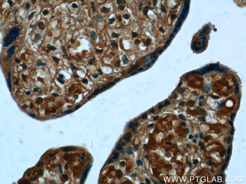 Immunohistochemistry (IHC) staining of human placenta tissue using PPBP,NAP2 Polyclonal antibody (13313-1-AP)