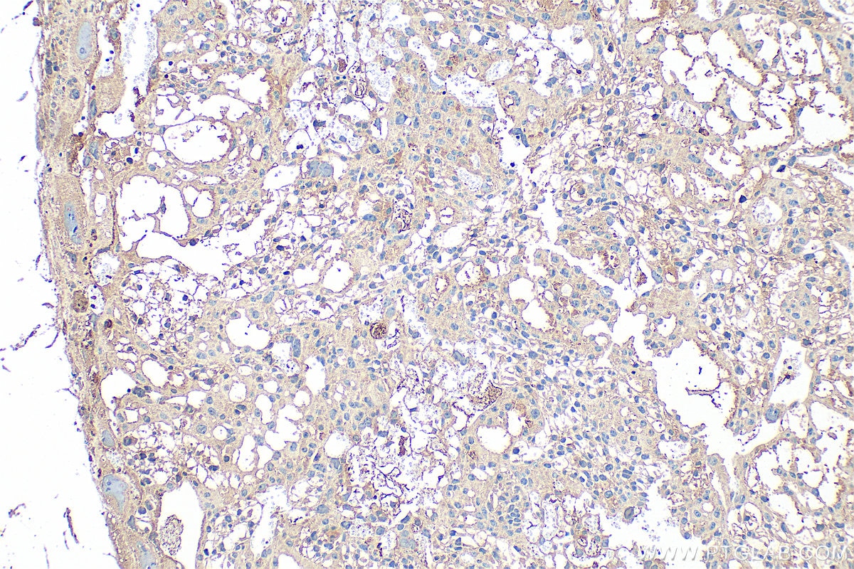 Immunohistochemistry (IHC) staining of mouse placenta tissue using CXCL7/PPBP Polyclonal antibody (13313-1-AP)