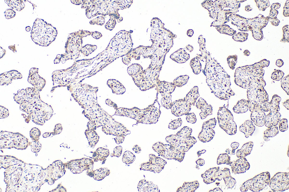 Immunohistochemistry (IHC) staining of human placenta tissue using CXCL7/PPBP Polyclonal antibody (13313-1-AP)