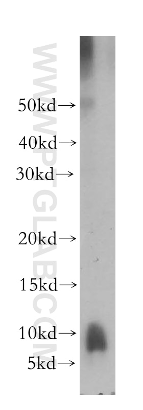 Western Blot (WB) analysis of mouse liver tissue using PPBP,NAP2 Polyclonal antibody (13313-1-AP)