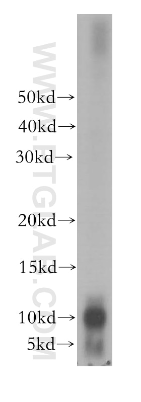 Western Blot (WB) analysis of human plasma using PPBP,NAP2 Polyclonal antibody (13313-1-AP)