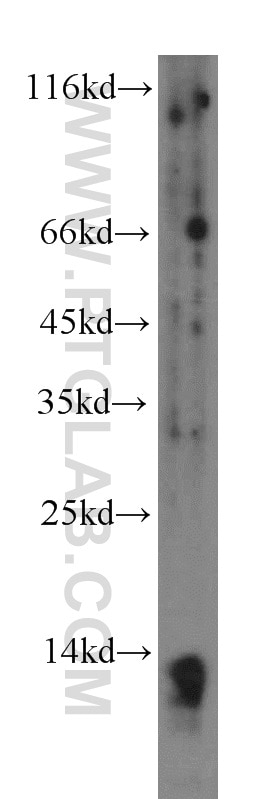 Western Blot (WB) analysis of human liver tissue using PPBP,NAP2 Polyclonal antibody (13313-1-AP)