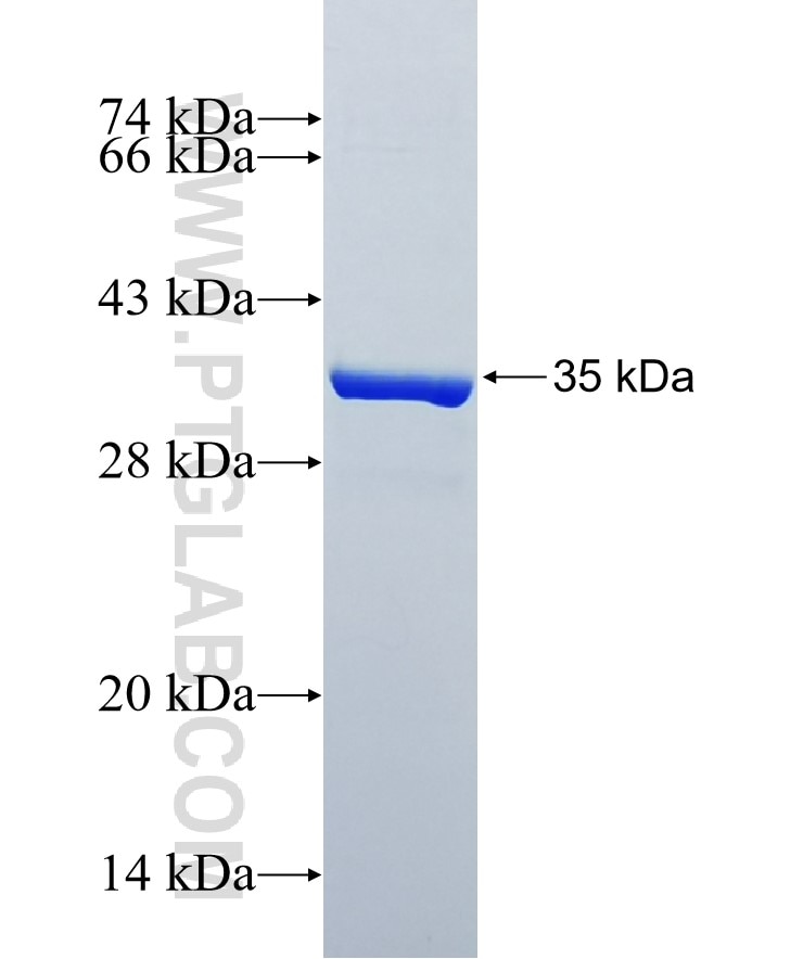 PPBP fusion protein Ag4147 SDS-PAGE