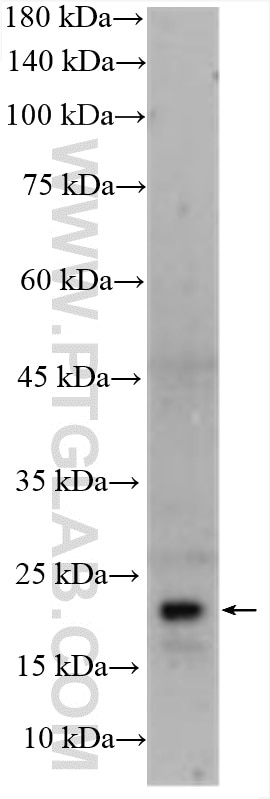 WB analysis of human placenta using 16270-1-AP